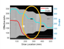 Clinical Experience with the Mercury 4.0 Phantom for CT Protocol Optimization